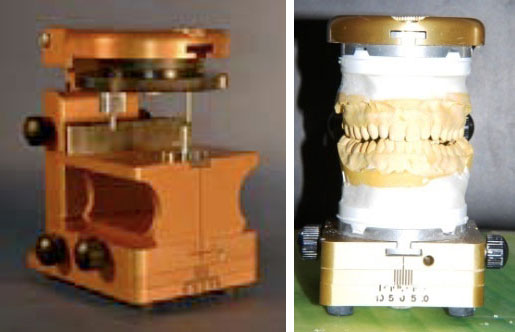 An Orthocranial Articulator